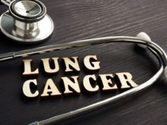 lung cancer